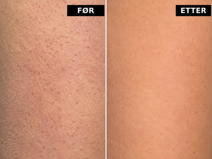 Smoothing Body Stick